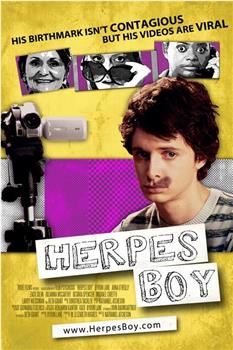 Herpes Boy观看